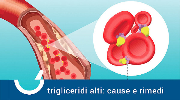 Trigliceridi alti? Scopriamo insieme cause e rimedi!